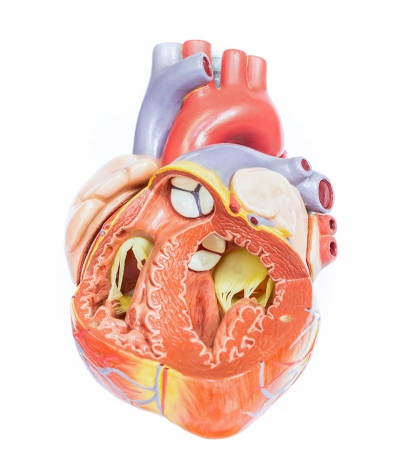 What is Pulmonary Valve Stenosis?